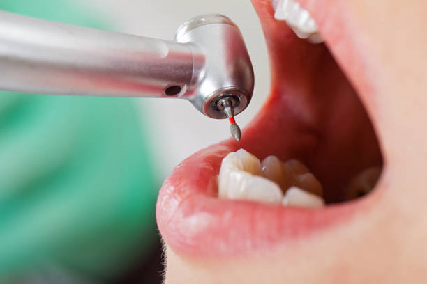 Best Emergency Dental Filling Replacement  in Chino Valley, AZ